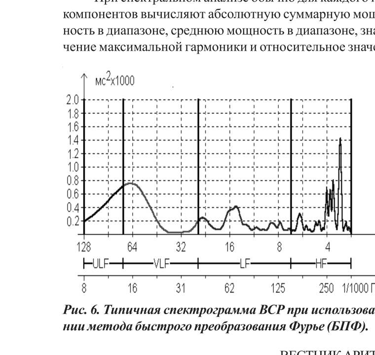 Рис. 6. Типичная спектрограмма ВСР при использовании метода быстрого преобразования Фурье (БПФ)